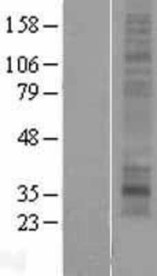 Western Blot: MMD2 Overexpression Lysate (Adult Normal) [NBP2-04734] Left-Empty vector transfected control cell lysate (HEK293 cell lysate); Right -Over-expression Lysate for MMD2.