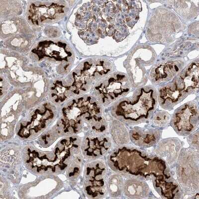 Immunohistochemistry-Paraffin: MMGT1 Antibody [NBP1-90652] - Staining of human kidney shows strong membranous positivity in cells of tubules