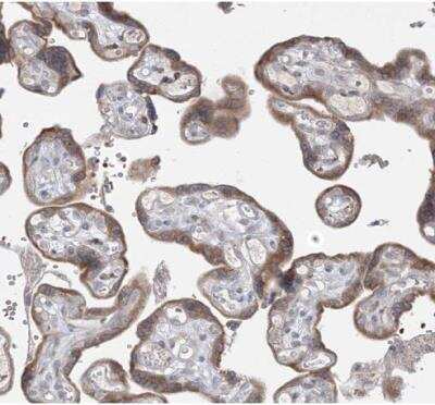 Immunohistochemistry-Paraffin: MMGT1 Antibody [NBP1-90652] - Staining of human placenta shows moderate granular cytoplasmic positivity in trophoblastic cells.