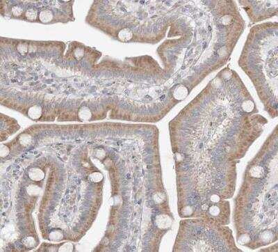 Immunohistochemistry-Paraffin: MMGT1 Antibody [NBP1-90652] - Staining of human duodenum shows weak granular cytoplasmic positivity in glandular cells.