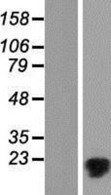 Western Blot: MMGT1 Overexpression Lysate (Adult Normal) [NBP2-05139] Left-Empty vector transfected control cell lysate (HEK293 cell lysate); Right -Over-expression Lysate for MMGT1.