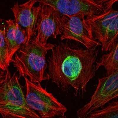 Immunocytochemistry/Immunofluorescence: MMP-1 Antibody (6A5) - Azide and BSA Free [NBP2-80852] - Immunofluorescence analysis of Hela cells using MMP1 mouse mAb (green). Blue: DRAQ5 fluorescent DNA dye. Red: Actin filaments have been labeled with Alexa Fluor-555 phalloidin. Image from the standard format of this antibody.