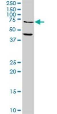 Western Blot: MMP-10 Antibody [H00004319-D01P] - Analysis of MMP10 expression in mouse lung.