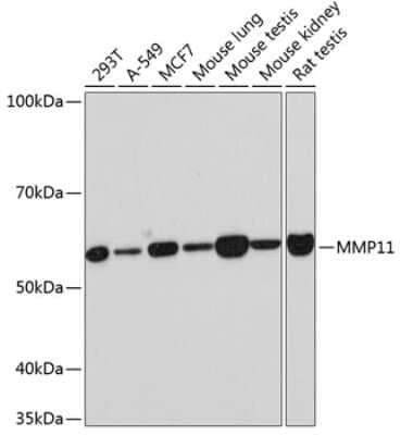 Western Blot: MMP-11 Antibody (8N9D3) [NBP3-15342] - Western blot analysis of extracts of various cell lines, using MMP-11 Rabbit mAb (NBP3-15342) at 1:1000 dilution. Secondary antibody: HRP Goat Anti-Rabbit IgG (H+L) at 1:10000 dilution. Lysates/proteins: 25ug per lane. Blocking buffer: 3% nonfat dry milk in TBST. Detection: ECL Basic Kit. Exposure time: 30s.