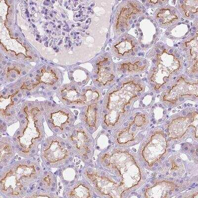 Immunohistochemistry-Paraffin: MMP-11 Antibody [NBP2-49575] - Staining of human kidney shows moderate luminal membranous positivity in cells in tubules.