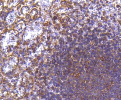 Immunohistochemistry-Paraffin: MMP-11 Antibody (SN74-08) [NBP2-67670] - Analysis of paraffin-embedded human spleen tissue using anti-MMP11 antibody. Counter stained with hematoxylin.