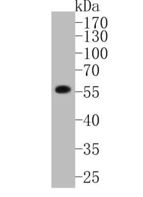 Western Blot: MMP-11 Antibody (SN74-08) [NBP2-67670] - Analysis of MMP11 on 293T cell lysates. Proteins were transferred to a PVDF membrane and blocked with 5% BSA in PBS for 1 hour at room temperature. The primary antibody (1/500) was used in 5% BSA at room temperature for 2 hours. Goat Anti-Rabbit IgG - HRP Secondary Antibody at 1:5,000 dilution was used for 1 hour at room temperature.