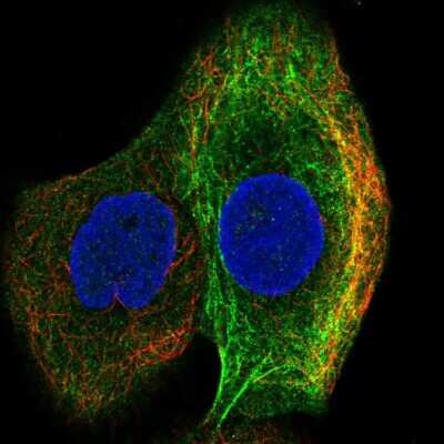 Immunocytochemistry/Immunofluorescence: MMP-14/MT1-MMP Antibody [NBP2-38649] - Staining of human cell line HaCaT shows localization to cytosol & intermediate filaments. Antibody staining is shown in green. 