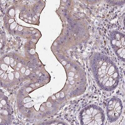 Immunohistochemistry-Paraffin: MMP-14/MT1-MMP Antibody [NBP2-38649] - Staining of human colon shows strong luminal membranous positivity in glandular cells.