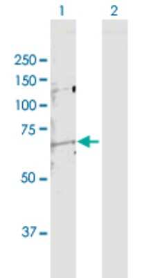 Western Blot: MMP-14/MT1-MMP Antibody [H00004323-D01P] - Analysis of MMP14 expression in transfected 293T cell line by MMP14 polyclonal antibody.Lane 1: MMP14 transfected lysate(65.90 KDa).Lane 2: Non-transfected lysate.