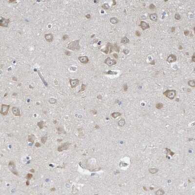 Immunohistochemistry-Paraffin: MMP-16/MT3-MMP Antibody [NBP1-86721] - Staining of human hippocampus shows moderate cytoplasmic positivity in neuronal cells.