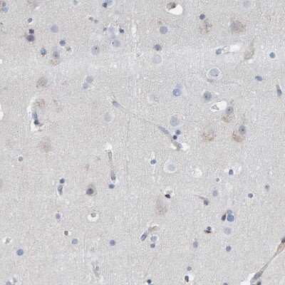 Immunohistochemistry-Paraffin: MMP-16/MT3-MMP Antibody [NBP1-86721] - Staining of human cerebral cortex shows weak cytoplasmic positivity in neurons.