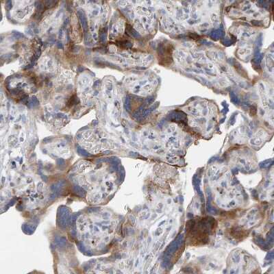 Immunohistochemistry-Paraffin: MMP-16/MT3-MMP Antibody [NBP1-86721] - Staining of human placenta shows moderate cytoplasmic positivity in trophoblastic cells.