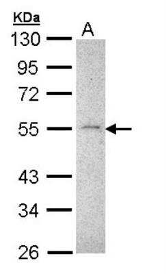 Western Blot: MMP-16/MT3-MMP Antibody [NBP1-33102] - (30 ug of whole cell lysate) Hep G2 10% SDS PAGE, antibody diluted at 1:1000.