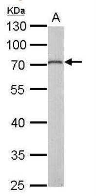 Western Blot: MMP-16/MT3-MMP Antibody [NBP1-33102] - A. 50 ug mouse kidney lysate/extract 10 % SDS-PAGEMMP16 antibody  dilution: 1:1000