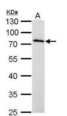 Western Blot: MMP-16/MT3-MMP Antibody [NBP1-33102] - A. 50 ug rat kidney lysate/extract 10 % SDS-PAGEMMP16 antibody dilution: 1:1000