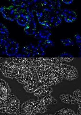 Immunohistochemistry-Paraffin: MMP-2 Antibody (2C1) [FITC] [NB200-113F] - Upper image: MMP-2 FITC (green), Dapi (blue)Lower image: phase contrast of human choroid plexus (Alzheimer's disease). Image from verified customer review.