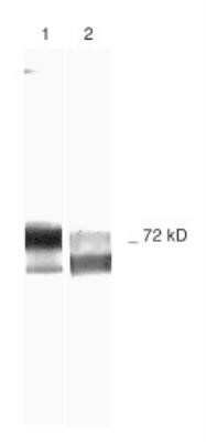 Western Blot: MMP-2 Antibody (2C1) - (Pro and Active) - Azide and BSA Free [NBP2-80853] - Samples: 1) Human Recombinant MMP-2, and 2)Schwann Cell Culture Medium Run on 10% SDS-PAGE, followed by electroblot to nitrocellulose and slot blot immunolabeling. Antibodies: primary - NB200-113, secondary - anti-mouse-biotin. Detection: avidin-HRP. Chromagen: DAB/H202. Image from the standard format of this antibody.