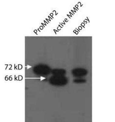 Western Blot: MMP-2 Antibody (8B4) - (Pro and Active) - Azide and BSA Free [NBP2-80854] - Analysis of MMP2 expression in ProMMP2 (1), Active MMP2 (2) and human pressure ulcer biopsy (3). Image from the standard format of this antibody.