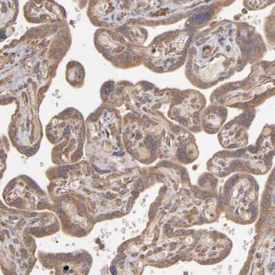 Immunohistochemistry-Paraffin: MMP-2 Antibody [NBP2-54667] - Staining of human placenta shows weak to moderate cytoplasmic positivity in trophoblastic cells.