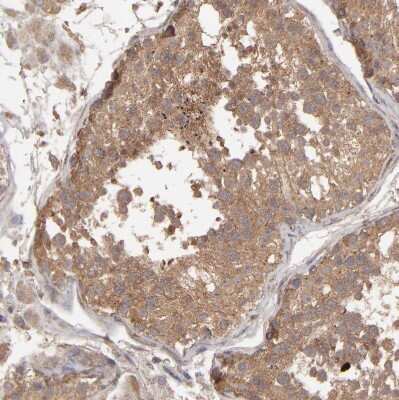 Immunohistochemistry-Paraffin: MMP-2 Antibody [NBP2-54667] - Staining of human testis shows weak to moderate cytoplasmic positivity in cells in seminiferous ducts.