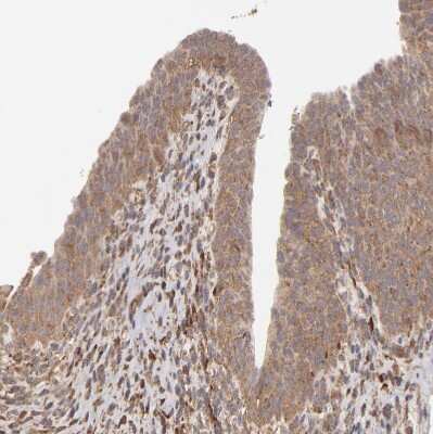 Immunohistochemistry-Paraffin: MMP-2 Antibody [NBP2-54667] - Staining of human urinary bladder shows weak to moderate cytoplasmic positivity in urothelial cells.