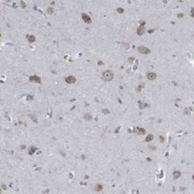 Immunohistochemistry-Paraffin: MMP-24/MT5-MMP Antibody [NBP3-17274] - Staining of human cerebral cortex shows cytoplasmic positivity in neuronal cells.