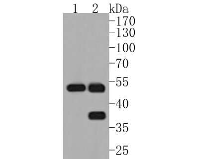 Western Blot: MMP-3 Antibody (JM46-22) [NBP2-75931] - Western blot analysis of MMP-3 on different lysates. Proteins were transferred to a PVDF membrane and blocked with 5% BSA in PBS for 1 hour at room temperature. The primary antibody (1/500) was used in 5% BSA at room temperature for 2 hours. Goat Anti-Rabbit IgG - HRP Secondary Antibody (HA1001) at 1:5,000 dilution was used for 1 hour at room temperature. Positive control: Lane 1: human liver tissue lysate Lane 2: rat liver tissue lysate