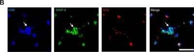 Immunocytochemistry/Immunofluorescence: MMP-8 Antibody [NBP1-85576] - Neurophil MMP-8 associates with NETs. Neutrophils were infected with M.tb MOI of 10 for 4 hours and NETs stained with DAPI (blue), anti-histone 2B (H2B, green) or anti-MMP-8 (green), while M.tb was stained with anti-M.tb Ab (red). Mtb induces NET formation which do not adhere to the shape of the neutrophil nuclei (White arrows). Scale bars represent 25 um. Image collected and cropped by CiteAb from the following publication (dx.plos.org/10.1371/journal.ppat.1004917), licensed under a CC-BY license.