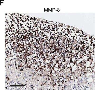 Immunohistochemistry-Paraffin: MMP-8 Antibody [NBP1-85576] - Neutrophil MMP-8 and -9 are upregulated in human TB. Magnified H&E and MMP-8 stains from Fig 1C inset shows neutrophils immunoreactive for MMP-8 around the cavity wall. Scale bar represent 50 um. Image collected and cropped by CiteAb from the following publication (journals.plos.org/plospathogens/article?id=10.1371/journal.ppat.1004917), licensed under a CC-BY license.