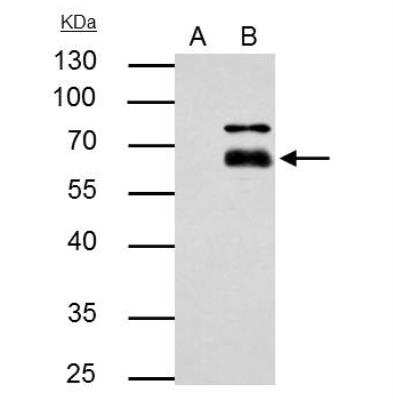 Immunoprecipitation: MMP-8 Antibody [NBP2-17316] - IP samples: A549 whole cell extract A. Control with 4 ug of preimmune Rabbit IgG B. Immunoprecipitation of MMP8 protein by 4 ug MMP8 antibody 10 % SDS-PAGE The immunoprecipitated MMP8 protein was detected by MMP8 antibody diluted at 1:500. [EasyBlot anti-rabbit IgG was used as a secondary reagent]