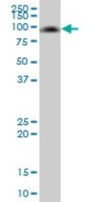 Western Blot: MMP-8 Antibody [H00004317-B01P] - Analysis of MMP8 expression in human liver.
