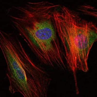 Immunocytochemistry/Immunofluorescence: MMP-9 Antibody (5G3) [NBP2-22181] - Analysis of NIH/3T3 cells using MMP9 mouse mAb (green). Blue: DRAQ5 fluorescent DNA dye. Red: Actin filaments have been labeled with Alexa Fluor-555 phalloidin.