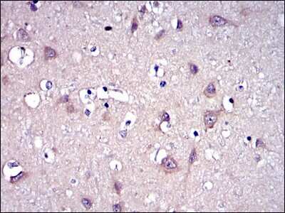 Immunohistochemistry-Paraffin: MMP-9 Antibody (5G3) [NBP2-22181] - Analysis of tissues using MMP9 mouse mAb with DAB staining.