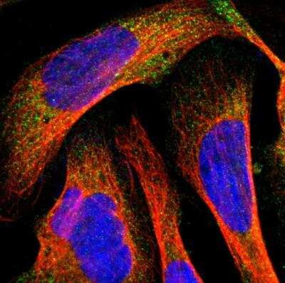 <b>Orthogonal Strategies Validation. </b>Immunocytochemistry/Immunofluorescence: MMP-9 Antibody [NBP1-85575] - Staining of human cell line U-2 OS shows localization to cytosol. Antibody staining is shown in green.