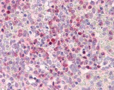 Immunohistochemistry-Paraffin: MMP-9 Antibody [NBP1-39597] - Analysis of anti-MMP-9 antibody with human spleen, neutrophils at concentration 5 ug/ml.