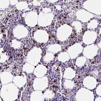 Immunohistochemistry-Paraffin: MMP-9 Antibody [NBP1-85575] - Staining of human bone marrow shows high expression.