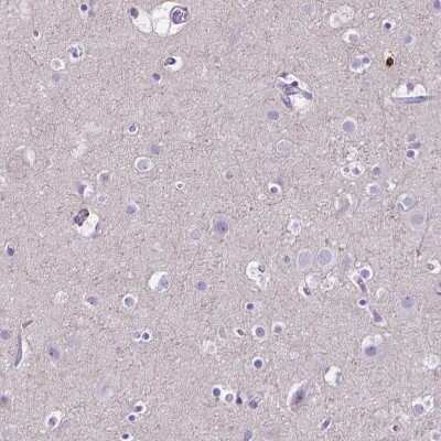 Immunohistochemistry-Paraffin: MMP-9 Antibody [NBP1-85575] - Staining of human cerebral cortex shows low expression as expected.