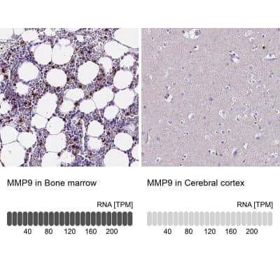 Immunohistochemistry-Paraffin: MMP-9 Antibody [NBP1-85575] - Staining in human bone marrow and cerebral cortex tissues using anti-MMP9 antibody. Corresponding MMP9 RNA-seq data are presented for the same tissues.