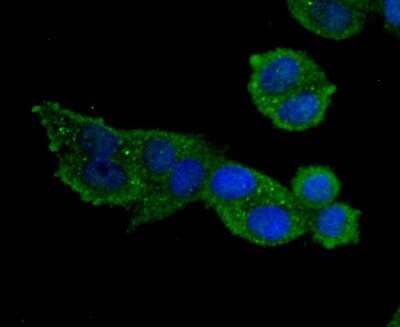 Immunocytochemistry/Immunofluorescence: MMP-9 Antibody (JA80-73) [NBP2-66955] - Staining MMP9 in Hela cells (green). The nuclear counter stain is DAPI (blue). Cells were fixed in paraformaldehyde, permeabilised with 0.25% Triton X100/PBS.