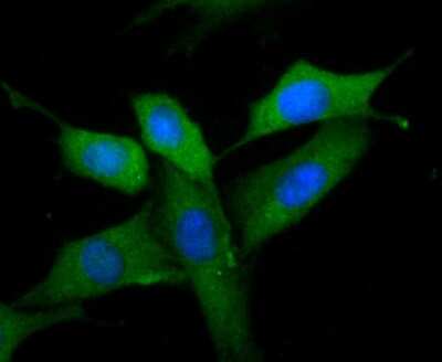 Immunocytochemistry/Immunofluorescence: MMP-9 Antibody (JA80-73) [NBP2-66955] - Staining MMP9 in SHG-44 cells (green). The nuclear counter stain is DAPI (blue). Cells were fixed in paraformaldehyde, permeabilised with 0.25% Triton X100/PBS.