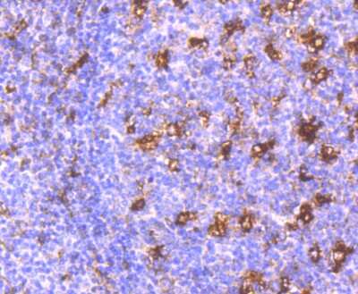 Immunohistochemistry-Paraffin: MMP-9 Antibody (JA80-73) [NBP2-66955] - Analysis of paraffin-embedded human tonsil tissue using anti-MMP9 antibody. Counter stained with hematoxylin.