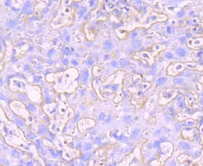 Immunohistochemistry-Paraffin: MMP-9 Antibody (JA80-73) [NBP2-66955] - Analysis of paraffin-embedded mouse placenta tissue using anti-MMP9 antibody. Counter stained with hematoxylin.