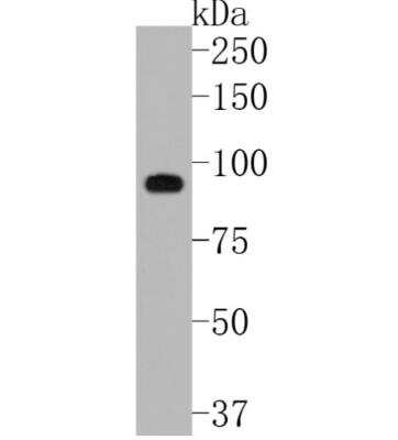 Western Blot: MMP-9 Antibody (JA80-73) [NBP2-66955] - Analysis of MMP9 on rat spleen tissue lysates. Proteins were transferred to a PVDF membrane and blocked with 5% BSA in PBS for 1 hour at room temperature. The primary antibody (1/500) was used in 5% BSA at room temperature for 2 hours. Goat Anti-Rabbit IgG - HRP Secondary Antibody at 1:5,000 dilution was used for 1 hour at room temperature.