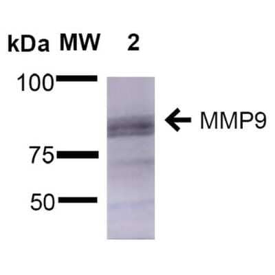 Western Blot: MMP-9 Antibody (S51-82) [NBP2-59699] - Western Blot analysis of Rat Brain showing detection of ~92 kDa and ~82 kDa (pro and active) MMP-9 protein using Mouse Anti-MMP-9 Monoclonal Antibody, Clone S51-82 (NBP2-59699). Lane 1: Molecular Weight Ladder (MW). Lane 2: Rat Brain. Load: 15 ug. Block: 5% Skim Milk in 1X TBST. Primary Antibody: Mouse Anti-MMP-9 Monoclonal Antibody (NBP2-59699) at 1:1000 for 2 hours at RT. Secondary Antibody: Goat Anti-Mouse IgG: HRP at 1:2000 for 60 min at RT. Color Development: ECL solution for 5 min at RT. Predicted/Observed Size: ~92 kDa and ~82 kDa (pro and active).