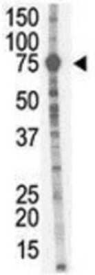 Western Blot: MMP-9 Antibody [NBP1-39597] - Analysis of anti-MMP-9 antibody with mouse liver tissue lysate.