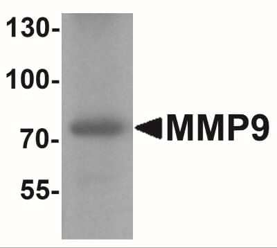 Western Blot: MMP-9 Antibody [NBP2-41233] - Analysis of MMP9 in mouse lung tissue lysate with MMP9 antibody at  1 ug/ml.