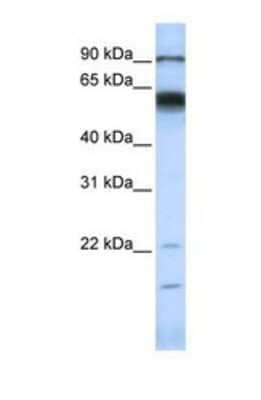 Western Blot: MMP16 Antibody [NBP1-69349] - This Anti-MMP16 antibody was used in Western Blot of MCF7 tissue lysate at a concentration of 1ug/ml.