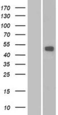 Western Blot: MMP16 Overexpression Lysate (Adult Normal) [NBP2-06425] Left-Empty vector transfected control cell lysate (HEK293 cell lysate); Right -Over-expression Lysate for MMP16.