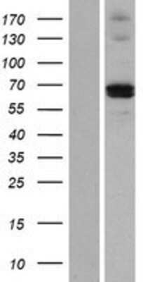 Western Blot: MMP21 Overexpression Lysate (Adult Normal) [NBP2-05438] Left-Empty vector transfected control cell lysate (HEK293 cell lysate); Right -Over-expression Lysate for MMP21.